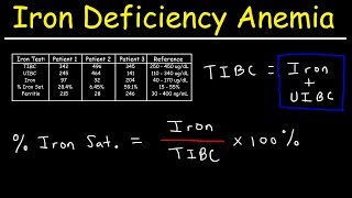 Iron Deficiency Anemia  TIBC UIBC Iron Saturation Transferrin amp Ferritin [upl. by Immot]