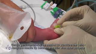 Paediatric Anaesthetics Chapter 7  Long saphenous IV neonate 1 [upl. by Oahc151]