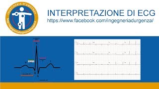 Interpretazione di ECG leggiamo insieme qualche elettrocardiogramma [upl. by Joshuah223]