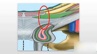 Inguinal Hernias Explained [upl. by Aldis]