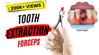 Dental extraction  Forceps [upl. by Nosirrag735]