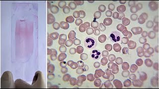 Blood Smear Preparation and Staining Practical Lab [upl. by Caravette680]