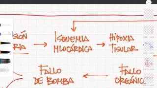 Medicina de urgencias Shock cardiogénico [upl. by Logan997]