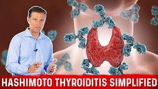 Hashimoto Thyroiditis Autoimmune Hypothyroid Simplified by Dr Berg [upl. by Deirdre]