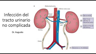 Infección de vías urinarias Microbiología Cuadro clínico Clasificación y Tratamiento actual [upl. by Amliv]