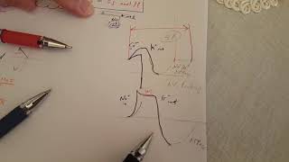 ECG made easy  Hyperkalemia amp Hypokalemia [upl. by Loris]