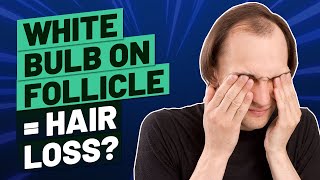 White Bulb on Hair Follicle What Does It Mean [upl. by Annatnom]