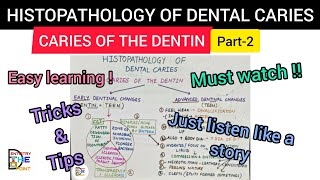 HISTOPATHOLOGY OF DENTAL CARIES  CARIES OF THE DENTIN PART2 [upl. by Mode116]