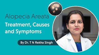 Alopecia Areata  Treatment Causes and Symptoms by Dr T N Rekha Singh [upl. by Introc]