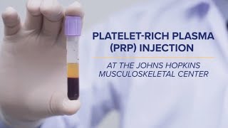 PlateletRich Plasma PRP Injections  QampA [upl. by Eisle]