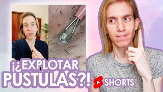 Como NO tratar los granos con pus  Recomendación de un Dermatólogo shorts [upl. by Jacquelin971]