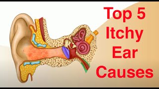 Top 5 Causes of Itchy Ears and Treatment Too [upl. by Quillan]