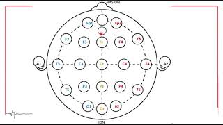 EEG Sistema 1020 [upl. by Nnylrats244]