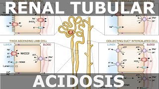 Renal Tubular Acidosis [upl. by Cynthia]