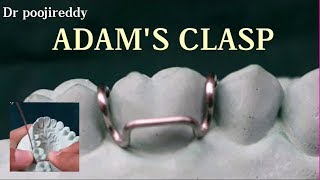 Adams clasp Adams clasp fabrication Dr poojireddy [upl. by Tihor]