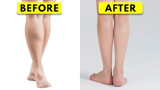 How I Slimmed Down My HUGE Calves  Scientific Approach [upl. by Malloy]