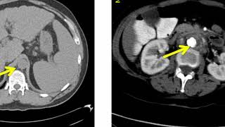 Introduction to Radiology Computed Tomography [upl. by Yancey]