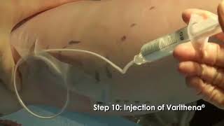 Venous Drainage of the Upper Extremities [upl. by Drofkcor]