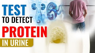 Test to detect Protein in Urine  Proteinuria Test [upl. by Atirahc]