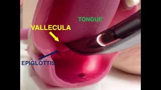 Incorrect and Corrected Endotrachial Intubation [upl. by Acinoda]