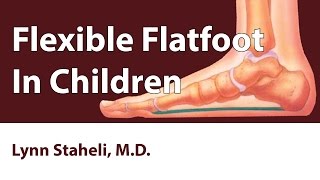 Flexible Flatfoot In Children [upl. by Gnilhsa452]