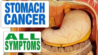 Pancreatic Cancer  All Symptoms [upl. by Svirad]