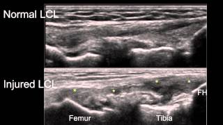 Knee joint structure and actions [upl. by Clover169]