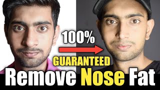 Mote Naak Ko Patla Kaise Karen  Guaranteed 100  How To Remove Nose Fat Slim Nose  Sharpen Nose [upl. by Lucila32]