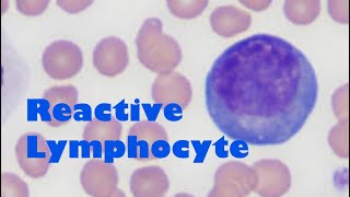 What does a reactive lymphocyte look like [upl. by Iong667]