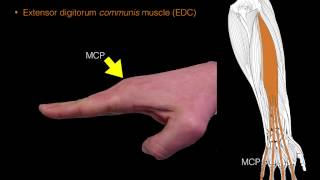 Forearm extensor muscles [upl. by Anihcak355]