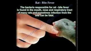 Rat Bite Fever  Everything You Need To Know  Dr Nabil Ebraheim [upl. by Nivonod]