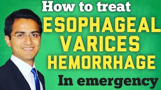 Patient education Esophageal varices The Basics [upl. by Hillard]