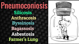 Pneumoconiosis  Silicosis  Anthracosis  Asbestosis  PSM lecture  Community Medicine lecture [upl. by Leone213]