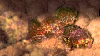 Cancer Cells Undergoing Mitosis [upl. by Timmi712]