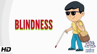 Blindness Causes Signs and Symptoms Diagnosis and Treatment [upl. by Kristo785]