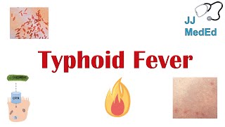 Typhoid Fever Pathogenesis vectors bacteria Symptoms Diagnosis Treatment Vaccine [upl. by Bambie]