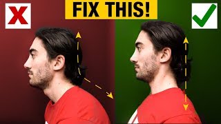 How to Fix Forward Head  Slumped Posture PERMANENTLY [upl. by Notle]