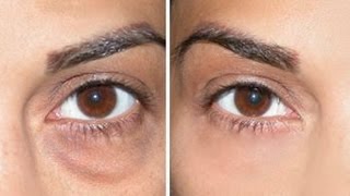 How to Cover Dark Circles  Under Eye Bags [upl. by Ellynad]