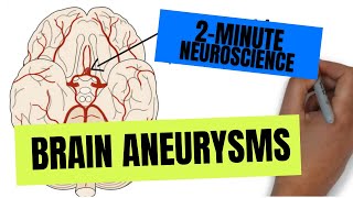 2Minute Neuroscience Brain Aneurysms [upl. by Filmer834]