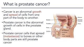 Prostate Cancer Warning Signs [upl. by Annim]