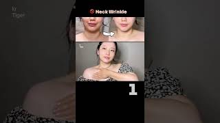 38세 셀프경락 얼굴의 뿌리 쇄골에 영양 수분 산소를 Neck wrinkles removal [upl. by Ggerc980]