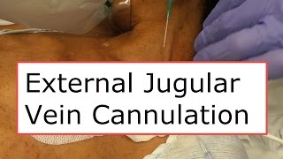 External Jugular Vein Cannulation [upl. by Suolevram]