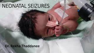 Neonatal Seizures  Pediatrics [upl. by Lanni]