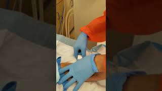 Arteriovenous AVF Cannulation 101 [upl. by Axia]