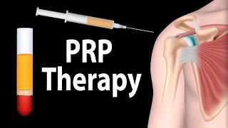 PRP Therapy Animation [upl. by Alicea]