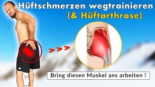 Hüftschmerzen sind KEINE Hüftarthrose  Ursache amp Lösung durch Übungen [upl. by Ateiluj]