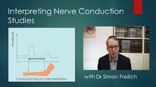 Interpreting Nerve Conduction Studies [upl. by Eniwtna628]