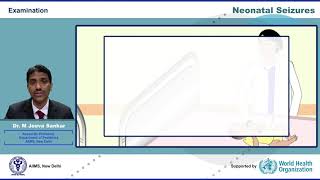 Neonatal Seizures [upl. by Razid]