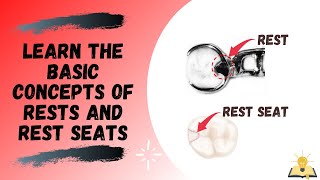 Rests and Rest Seats  The Basics  Removable Partial Denture RPD [upl. by Schach799]