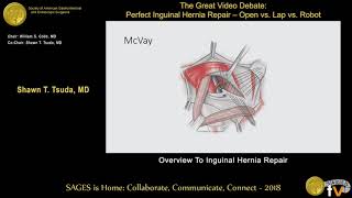 Overview inguinal hernia repair [upl. by Nalrah74]